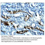Anti-TOMM5 Antibody from FabGennix (TOM5-501AP) - Antibodies.com