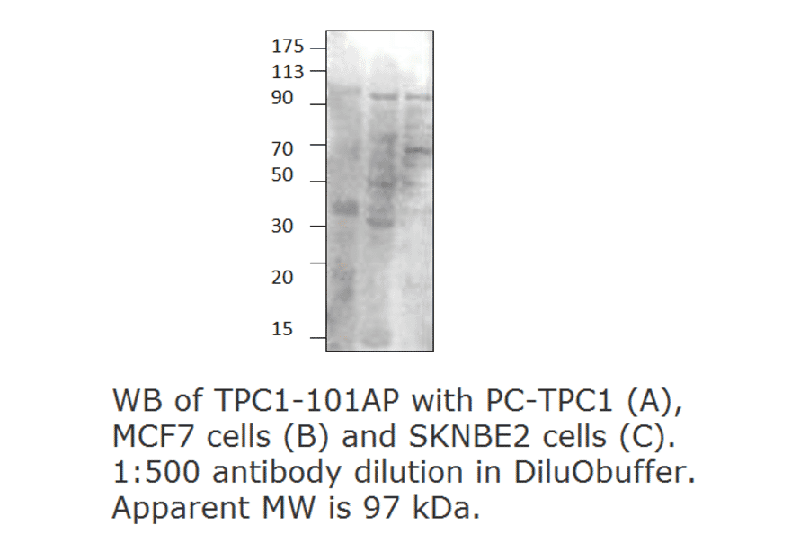 Anti-TPCN1 Antibody from FabGennix (TPC1-101AP) - Antibodies.com