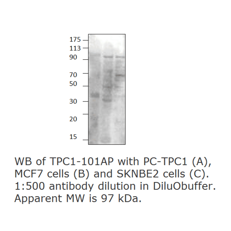 Anti-TPCN1 Antibody from FabGennix (TPC1-101AP) - Antibodies.com