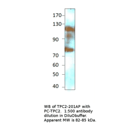 Anti-TPCN2 Antibody from FabGennix (TPC2-201AP) - Antibodies.com