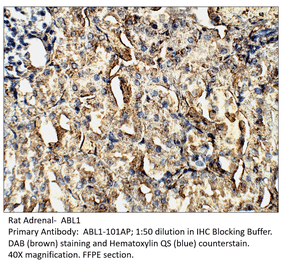 Anti-ABL1 Antibody from FabGennix (ABL1-101AP) - Antibodies.com