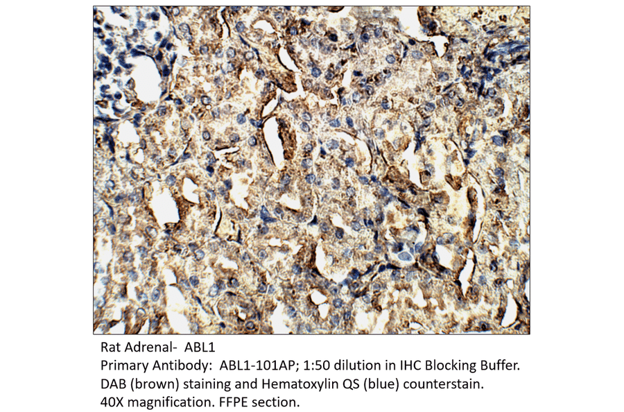 Anti-ABL1 Antibody from FabGennix (ABL1-101AP) - Antibodies.com