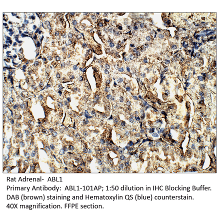 Anti-ABL1 Antibody from FabGennix (ABL1-101AP) - Antibodies.com
