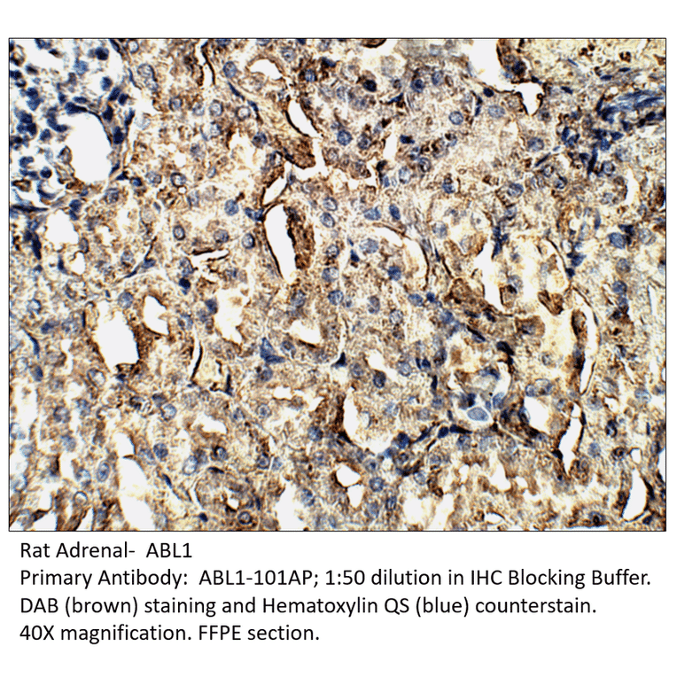Anti-ABL1 Antibody from FabGennix (ABL1-101AP) - Antibodies.com
