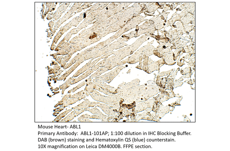 Anti-ABL1 Antibody from FabGennix (ABL1-101AP) - Antibodies.com