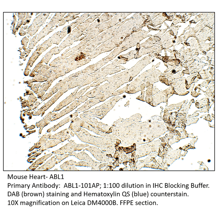 Anti-ABL1 Antibody from FabGennix (ABL1-101AP) - Antibodies.com
