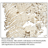 Anti-ABL1 Antibody from FabGennix (ABL1-101AP) - Antibodies.com