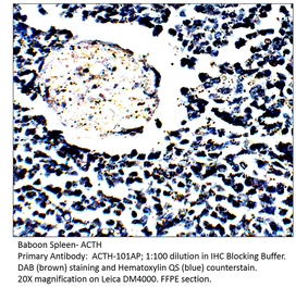 Anti-ACTH Antibody from FabGennix (ACTH-101AP) - Antibodies.com