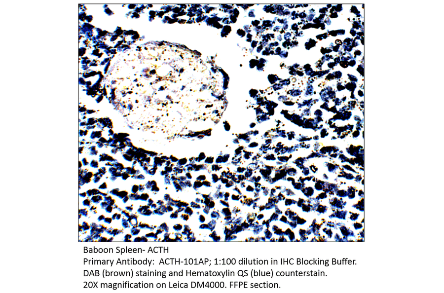 Anti-ACTH Antibody from FabGennix (ACTH-101AP) - Antibodies.com