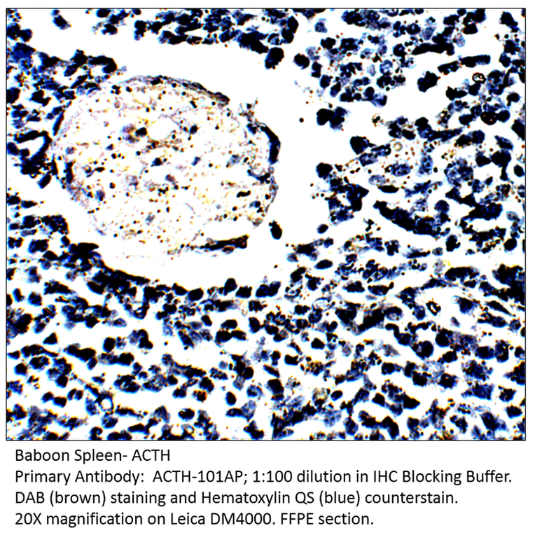 Anti-ACTH Antibody from FabGennix (ACTH-101AP) - Antibodies.com