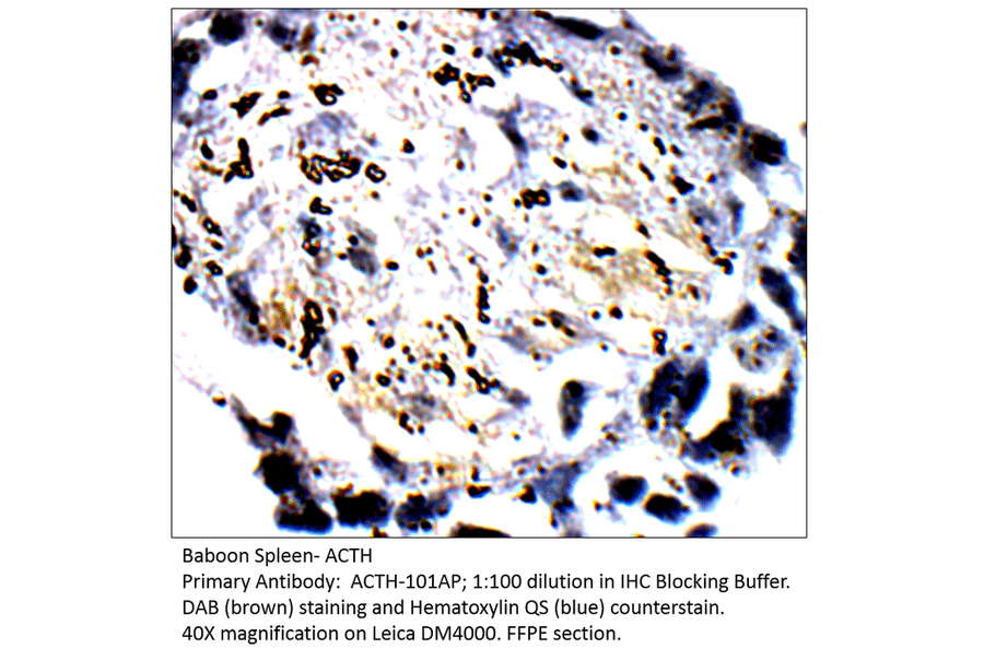 Anti-ACTH Antibody from FabGennix (ACTH-101AP) - Antibodies.com