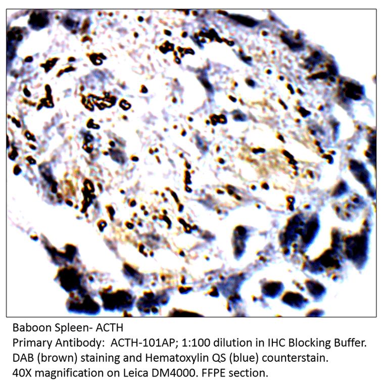 Anti-ACTH Antibody from FabGennix (ACTH-101AP) - Antibodies.com