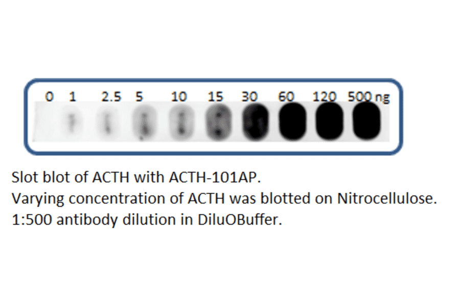 Anti-ACTH Antibody from FabGennix (ACTH-101AP) - Antibodies.com