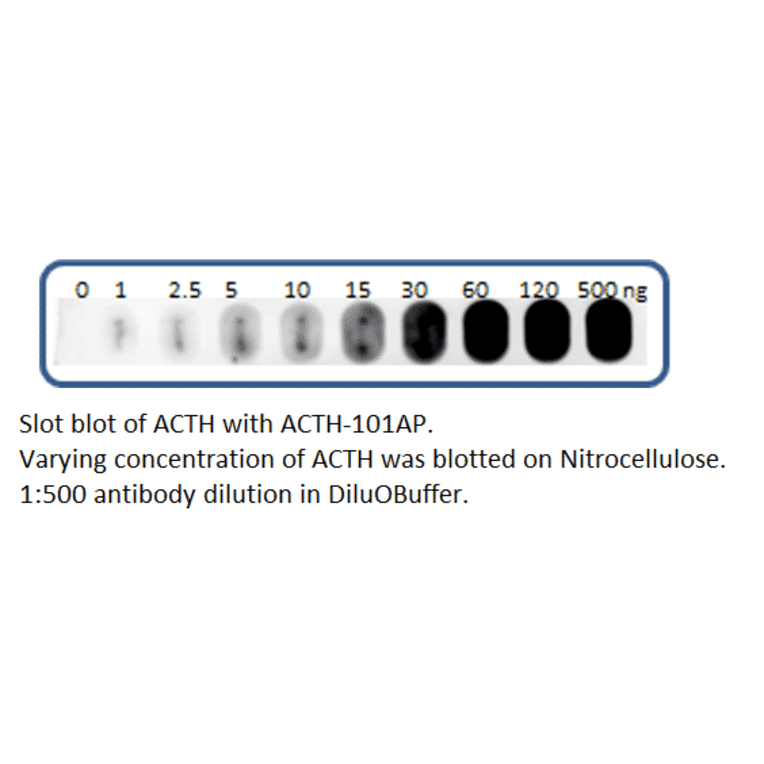 Anti-ACTH Antibody from FabGennix (ACTH-101AP) - Antibodies.com