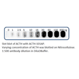 Anti-ACTH Antibody from FabGennix (ACTH-101AP) - Antibodies.com