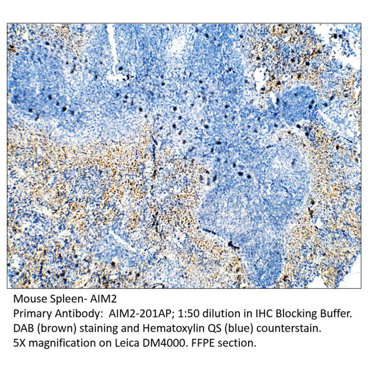 Anti-AIM2 Antibody from FabGennix (AIM2-201AP) - Antibodies.com