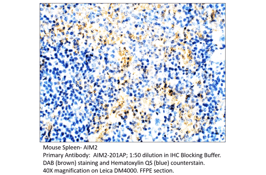 Anti-AIM2 Antibody from FabGennix (AIM2-201AP) - Antibodies.com