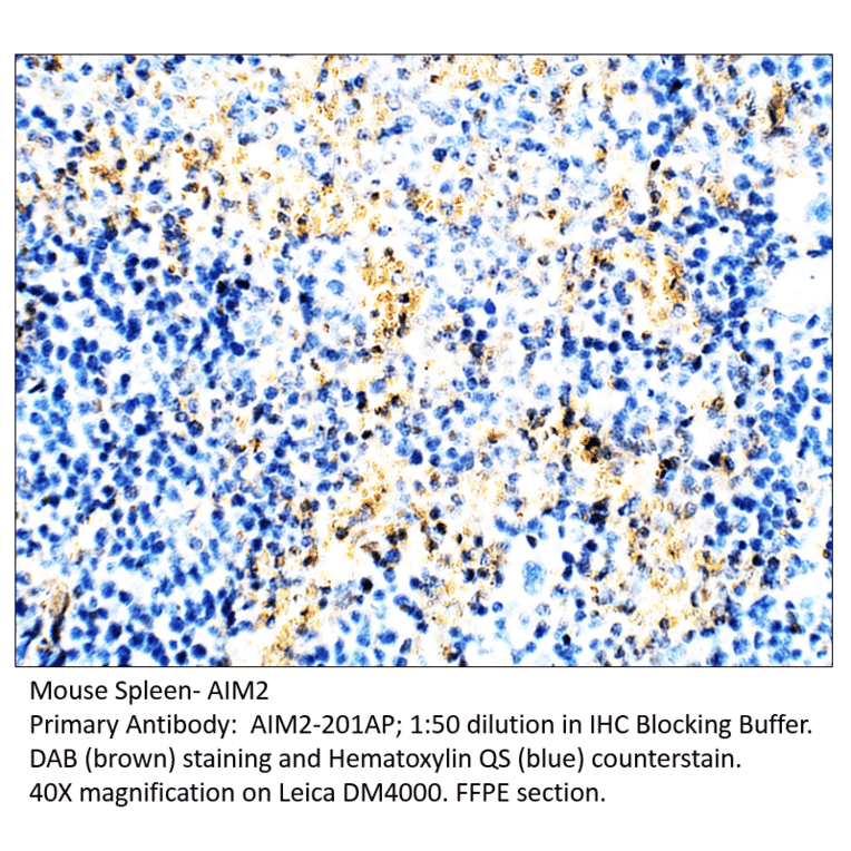 Anti-AIM2 Antibody from FabGennix (AIM2-201AP) - Antibodies.com