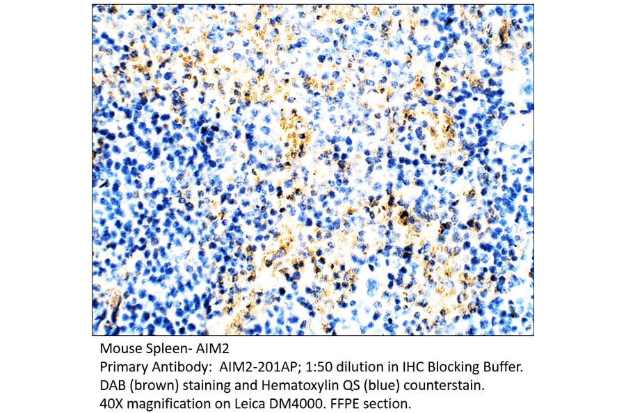 Anti-AIM2 Antibody from FabGennix (AIM2-201AP) - Antibodies.com