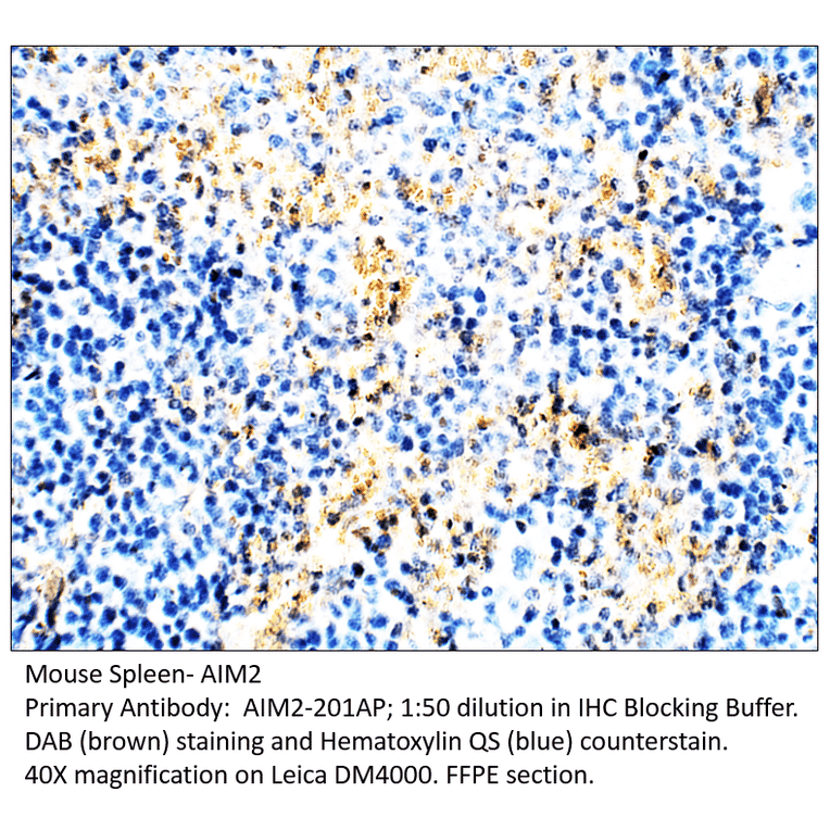 Anti-AIM2 Antibody from FabGennix (AIM2-201AP) - Antibodies.com