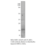 Anti-ARF1 Antibody from FabGennix (ARF1-101AP) - Antibodies.com