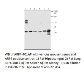 Anti-ARF4 Antibody from FabGennix (ARF4-401AP) - Antibodies.com