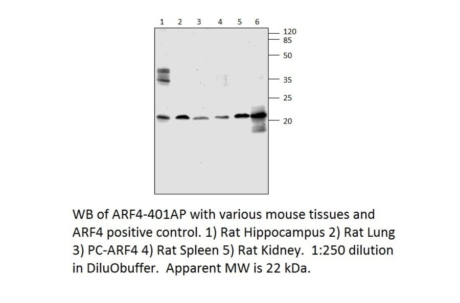 Anti-ARF4 Antibody from FabGennix (ARF4-401AP) - Antibodies.com
