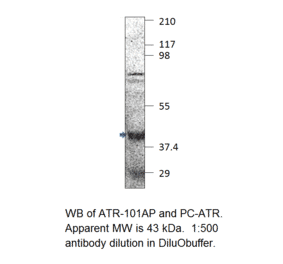 Anti-Fbx32 Antibody from FabGennix (ATR-101AP) - Antibodies.com