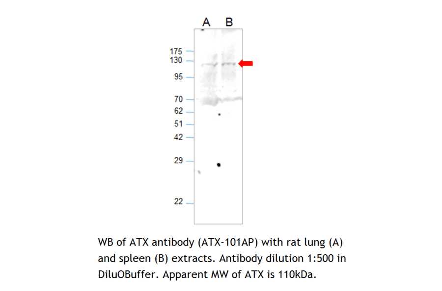 Anti-ENPP2 Antibody from FabGennix (ATX-101AP) - Antibodies.com