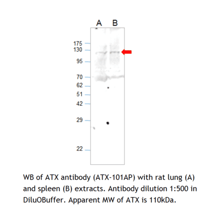 Anti-ENPP2 Antibody from FabGennix (ATX-101AP) - Antibodies.com
