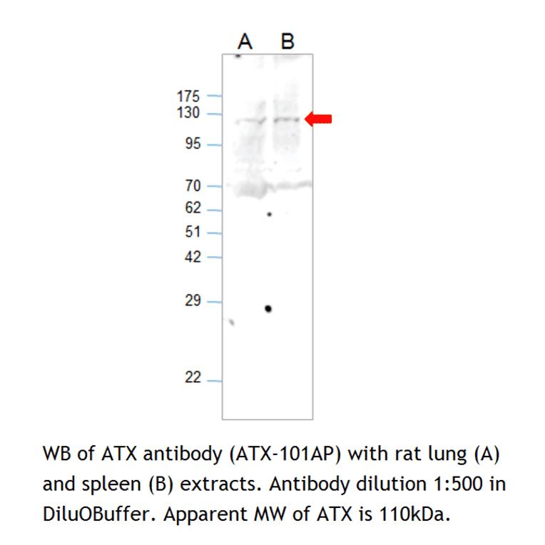 Anti-ENPP2 Antibody from FabGennix (ATX-101AP) - Antibodies.com