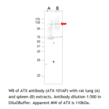 Anti-ENPP2 Antibody from FabGennix (ATX-101AP) - Antibodies.com