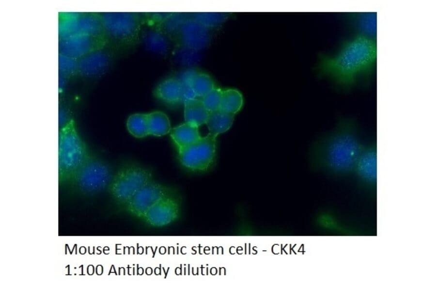Anti-CCK4 Antibody from FabGennix (CCK4-401AP) - Antibodies.com