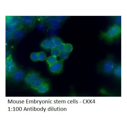 Anti-CCK4 Antibody from FabGennix (CCK4-401AP) - Antibodies.com