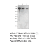 Anti-CCK4 Antibody from FabGennix (CCK4-401AP) - Antibodies.com