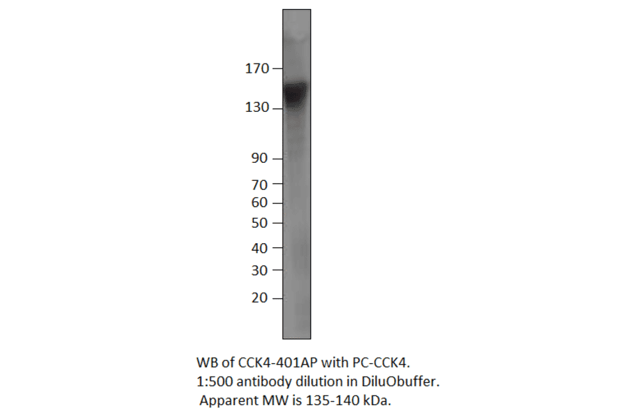 Anti-CCK4 Antibody from FabGennix (CCK4-401AP) - Antibodies.com