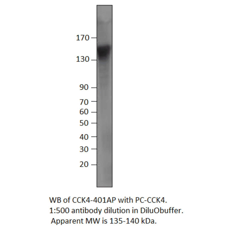 Anti-CCK4 Antibody from FabGennix (CCK4-401AP) - Antibodies.com