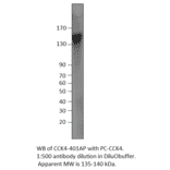 Anti-CCK4 Antibody from FabGennix (CCK4-401AP) - Antibodies.com