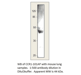 Anti-CCR1 Antibody from FabGennix (CCR1-101AP) - Antibodies.com