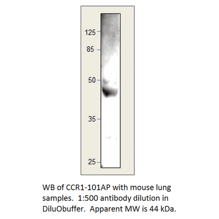 Anti-CCR1 Antibody from FabGennix (CCR1-101AP) - Antibodies.com