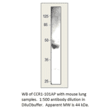 Anti-CCR1 Antibody from FabGennix (CCR1-101AP) - Antibodies.com