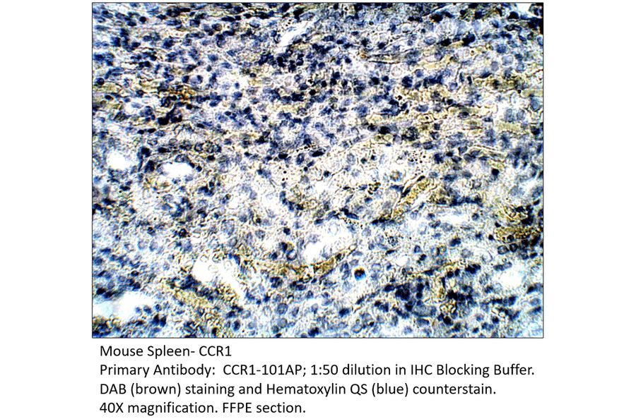 Anti-CCR1 Antibody from FabGennix (CCR1-101AP) - Antibodies.com