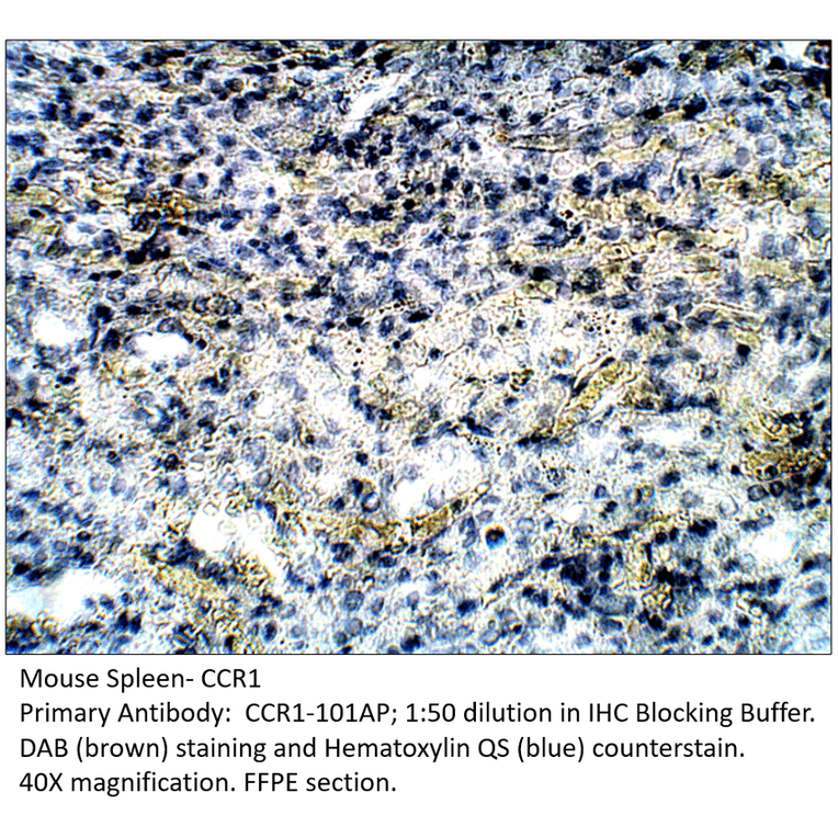 Anti-CCR1 Antibody from FabGennix (CCR1-101AP) - Antibodies.com