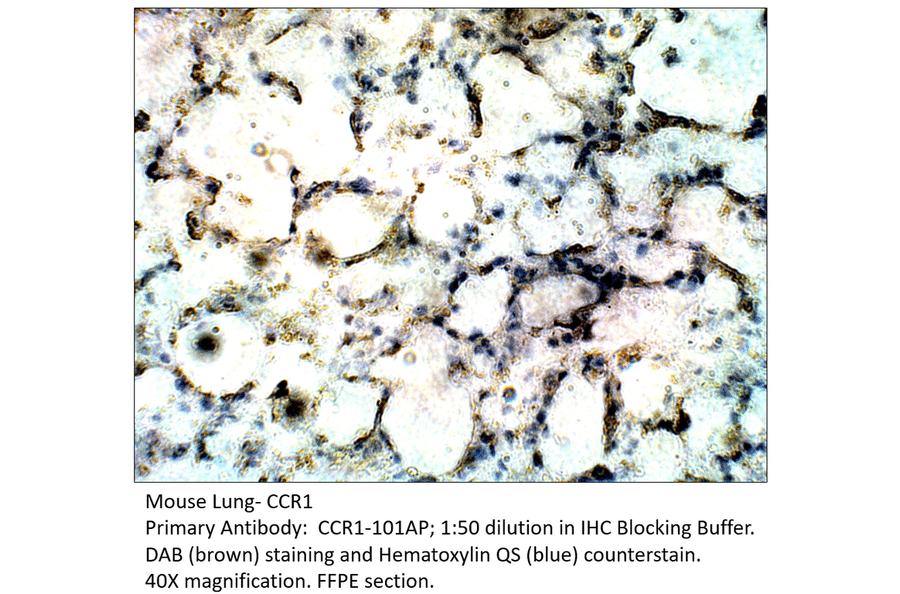 Anti-CCR1 Antibody from FabGennix (CCR1-101AP) - Antibodies.com