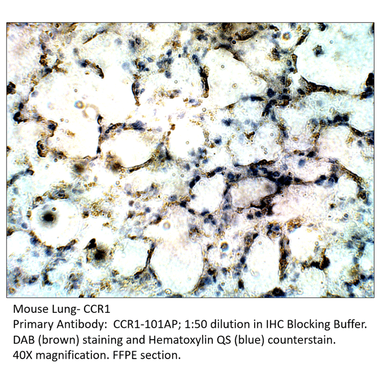Anti-CCR1 Antibody from FabGennix (CCR1-101AP) - Antibodies.com