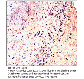 Anti-CCR3 Antibody from FabGennix (CCR3-301AP) - Antibodies.com