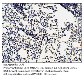 Anti-CCR5 Antibody from FabGennix (CCR5-501AP) - Antibodies.com