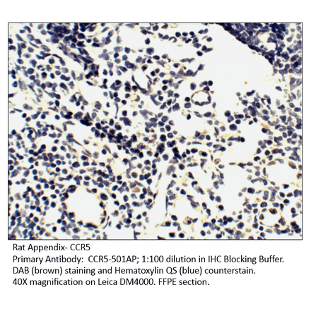 Anti-CCR5 Antibody from FabGennix (CCR5-501AP) - Antibodies.com