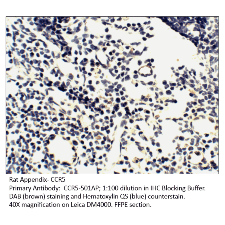 Anti-CCR5 Antibody from FabGennix (CCR5-501AP) - Antibodies.com