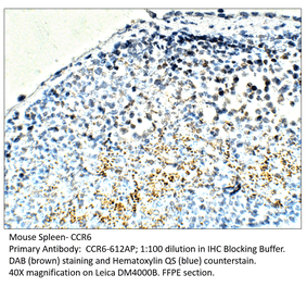 Anti-CCR6 Antibody from FabGennix (CCR6-612AP) - Antibodies.com